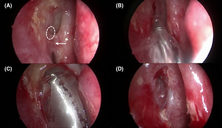 FIGURE 1