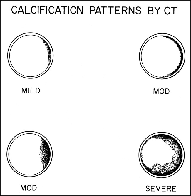 fig 1.