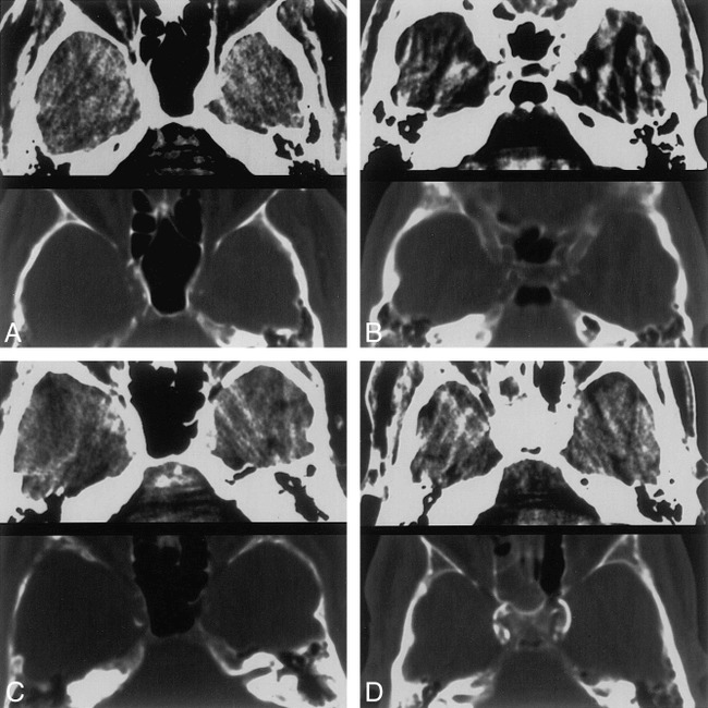 fig 2.