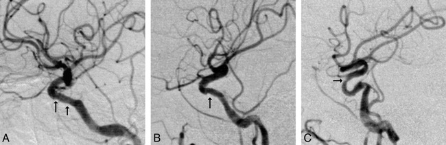 fig 3.