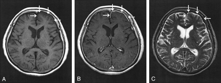 Fig 2.