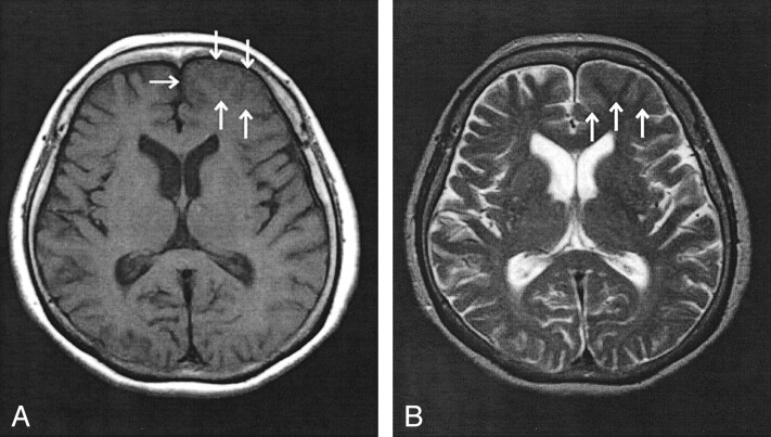 Fig 1.