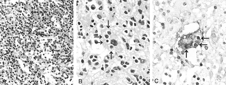 Fig 3.