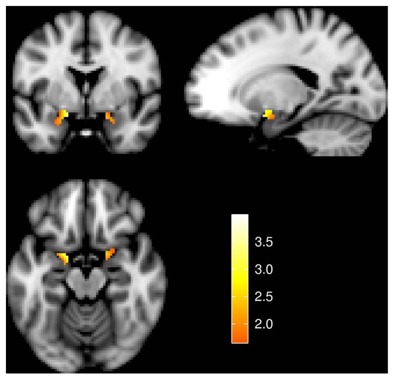 FIGURE 3