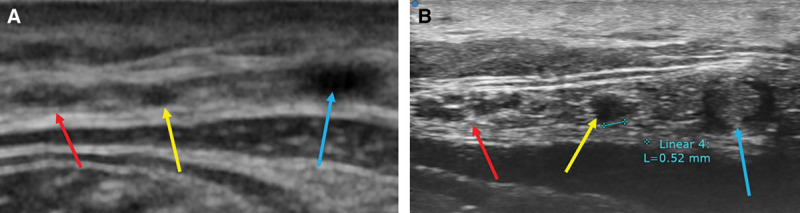 Fig. 3.