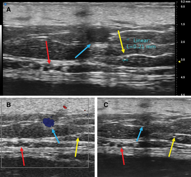 Fig. 4.