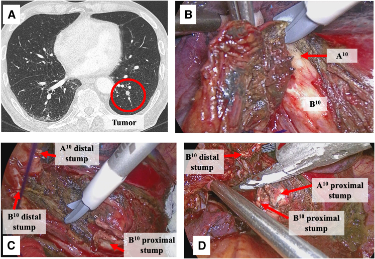 Figure 2