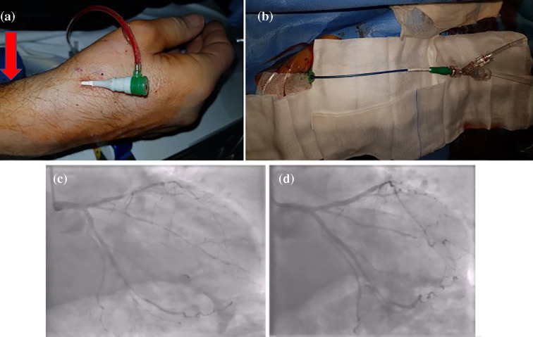 Fig. 2