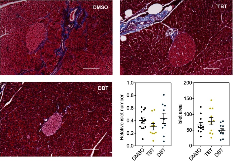 Three microscopic structures of pancreas of male animals each exposed to DMSO, TBT and 500 nanomolar DBT. The figure also comprises two plots with standard error of the mean each plotting the relative islet number and islet area (y-axis) for treatment with DMSO, TBT, and DBT (x-axis).