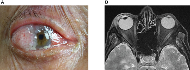 Figure 2