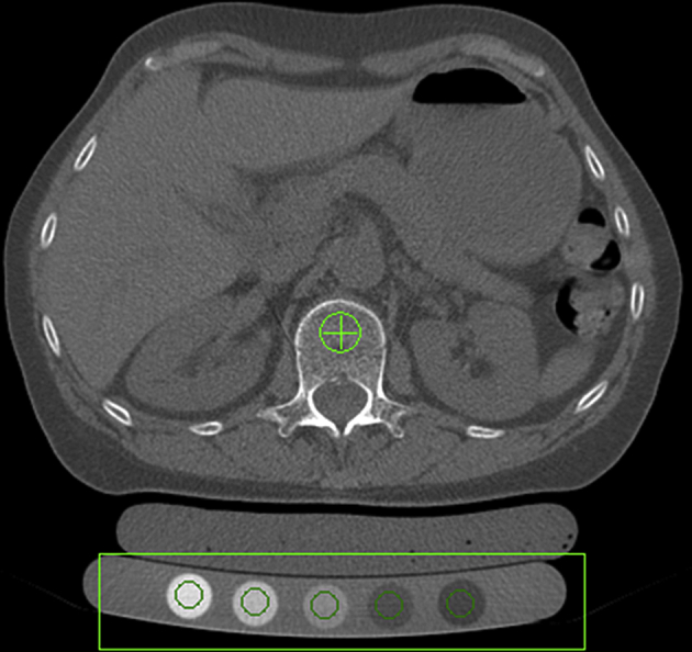 Figure 1