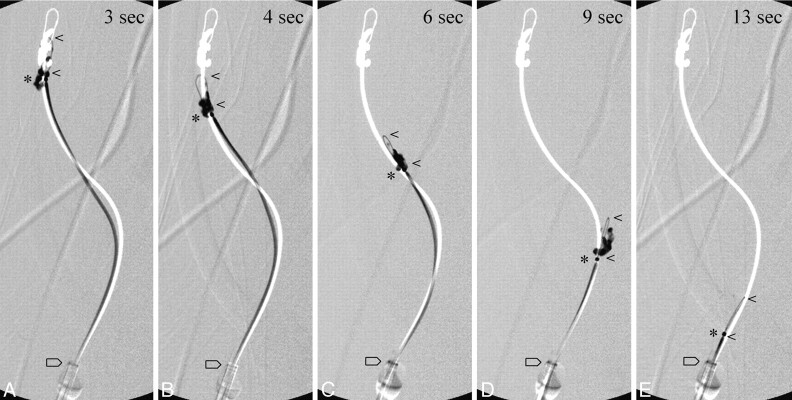 Fig 3.