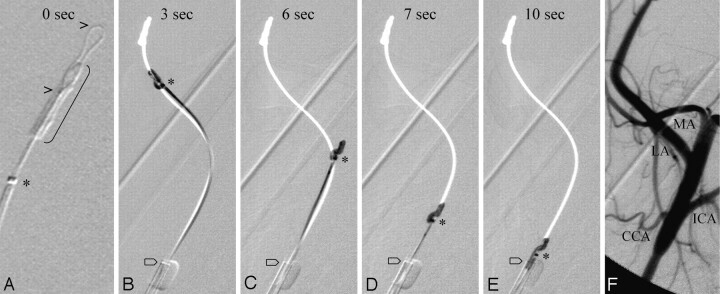 Fig 2.