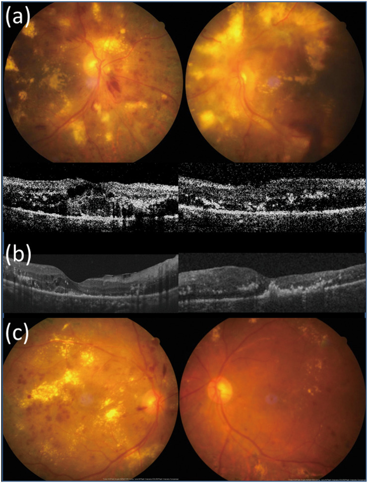 Fig 4