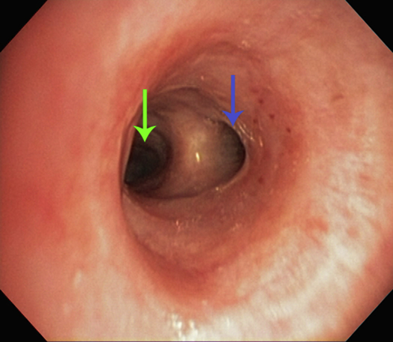 Fig. 3