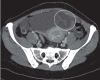 Figure 14.