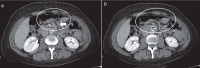 Figure 12.