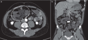 Figure 13.