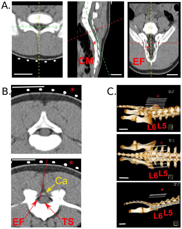 Pig Lumbar Spine Anatomy and Imaging Guided Lateral Lumbar Puncture: A ...