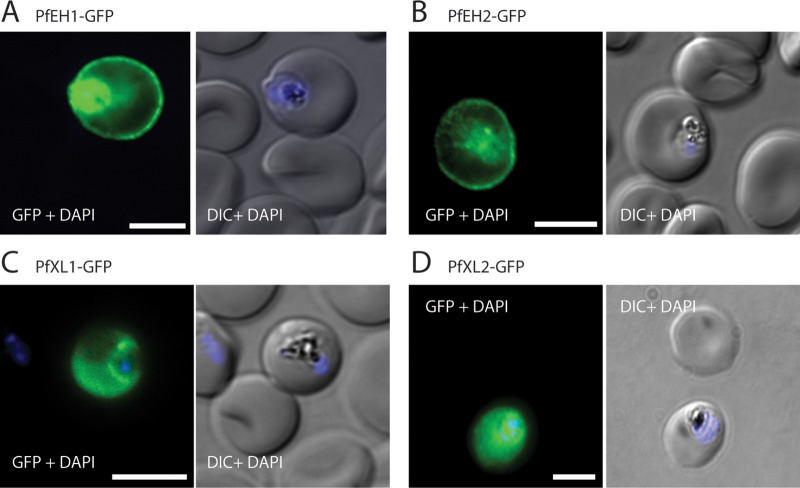 FIG 1 