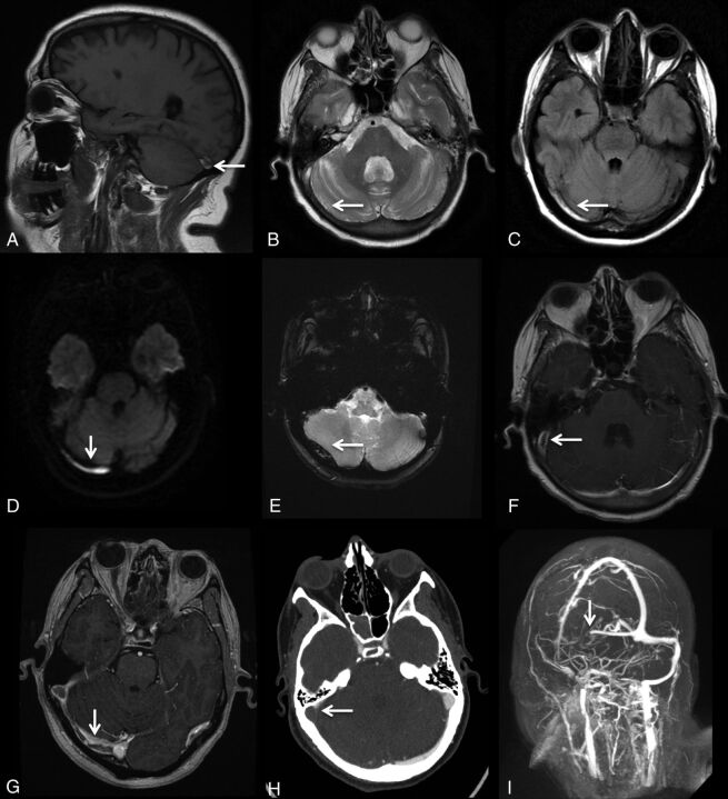 Fig 4.