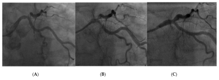 Figure 10