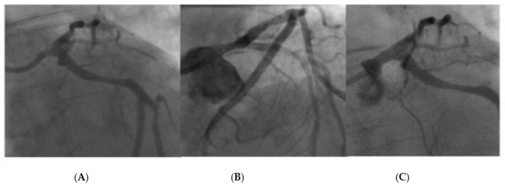 Figure 11