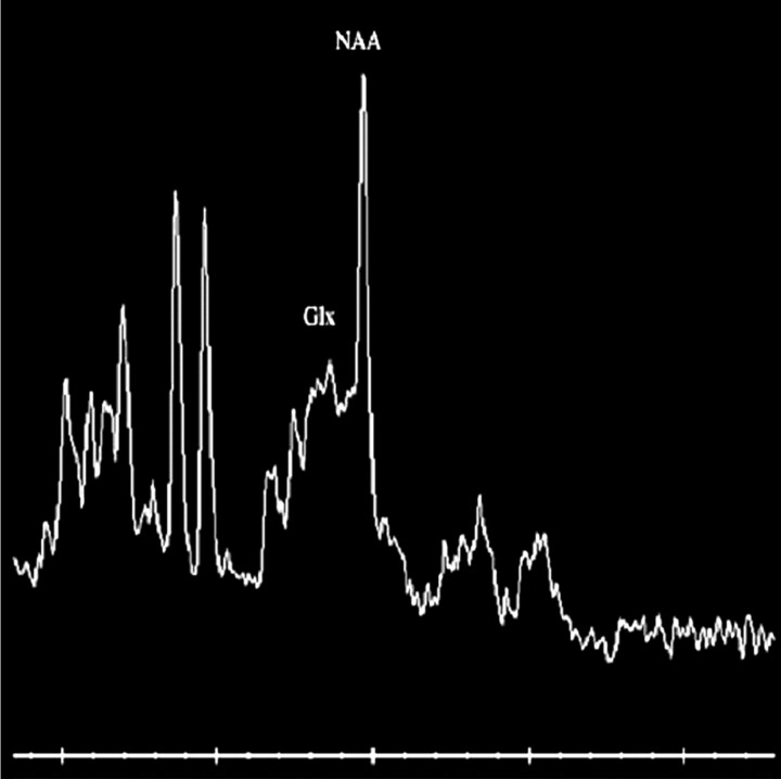 Fig 3.