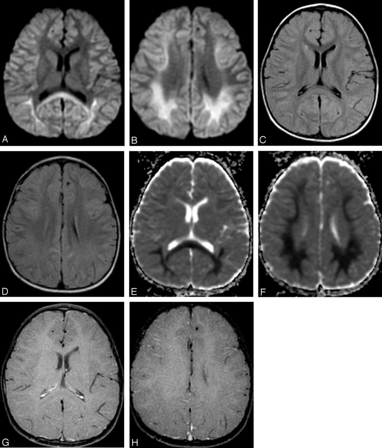 Fig 2.