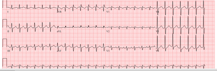 Figure 1