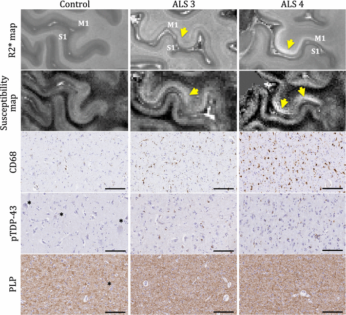Fig. 12