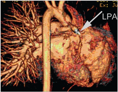 Figure 2b