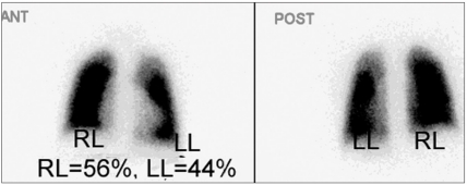 Figure 4b