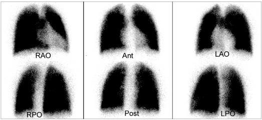 Figure 1a