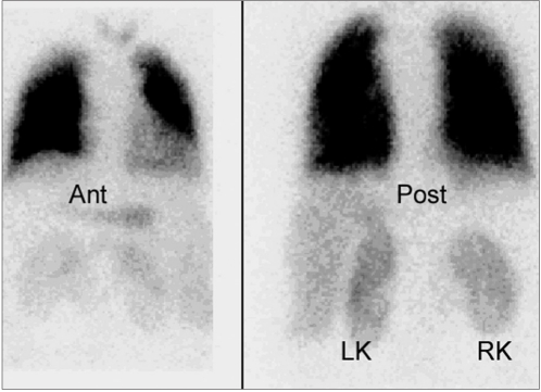 Figure 5a