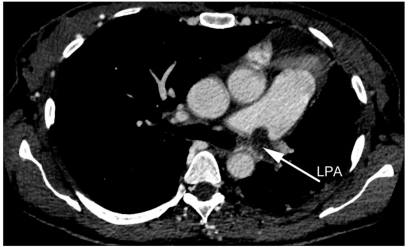 Figure 3b