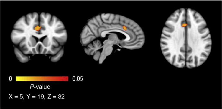 Fig. 1