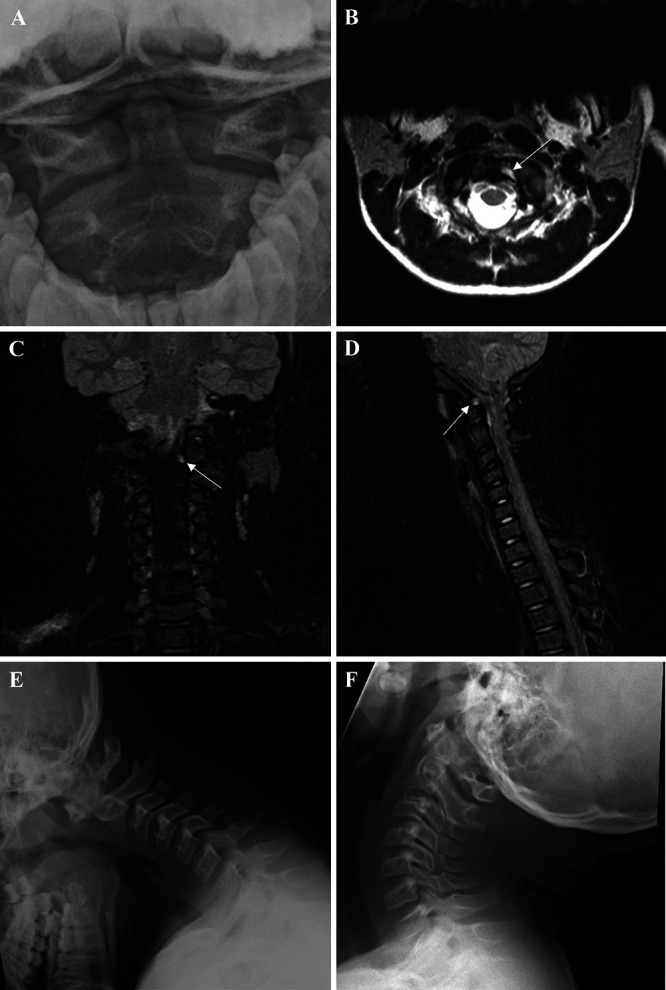 FIG. 1