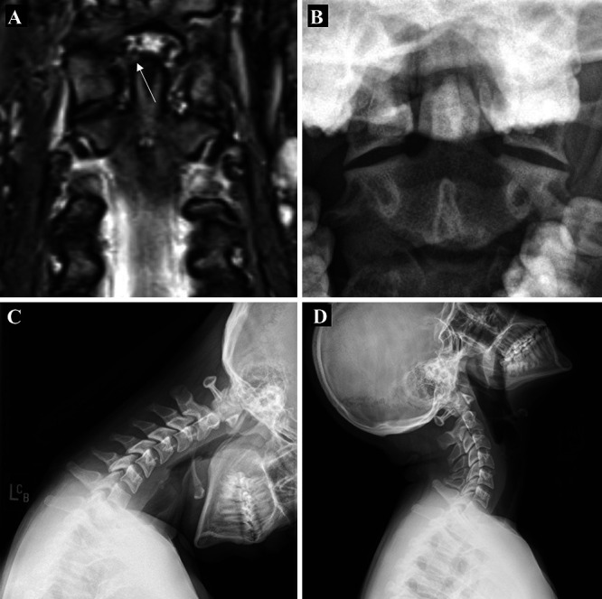 FIG. 3