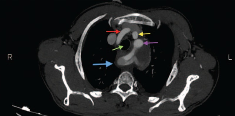 FIGURE 4