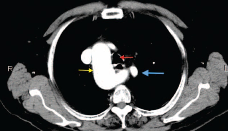 FIGURE 6