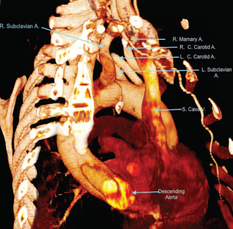 FIGURE 3