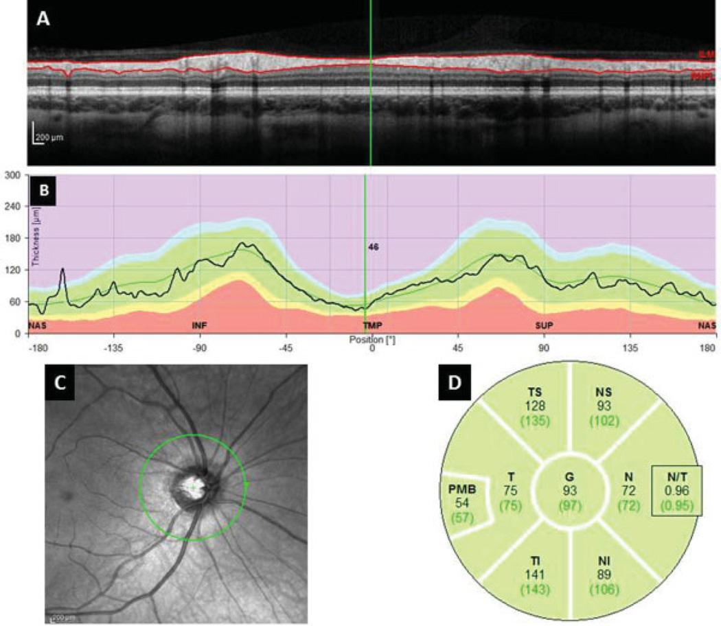 Fig. 2