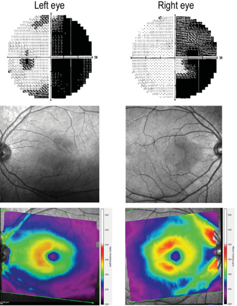 Fig. 4