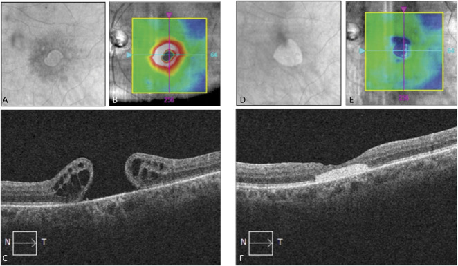 Fig. 2.