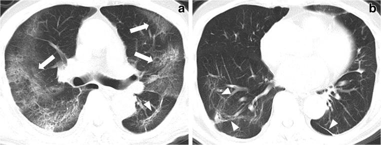 Fig. 5