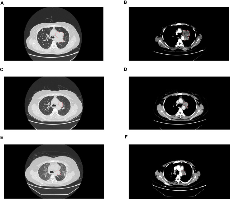 Figure 1