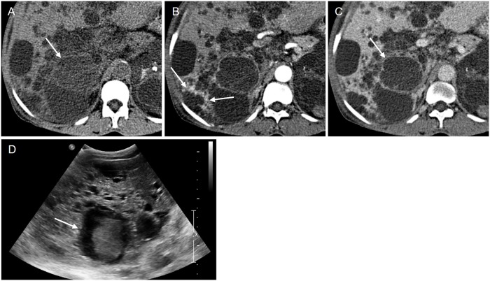 Fig 4