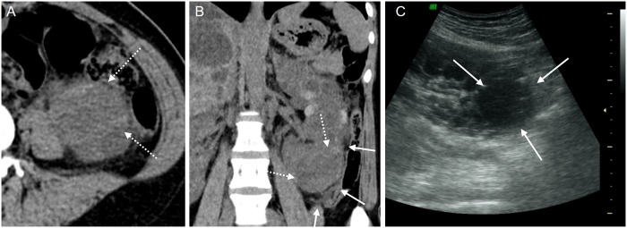 Fig 3