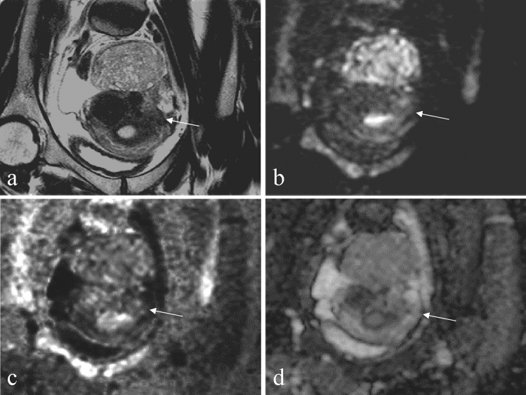 Fig. 5